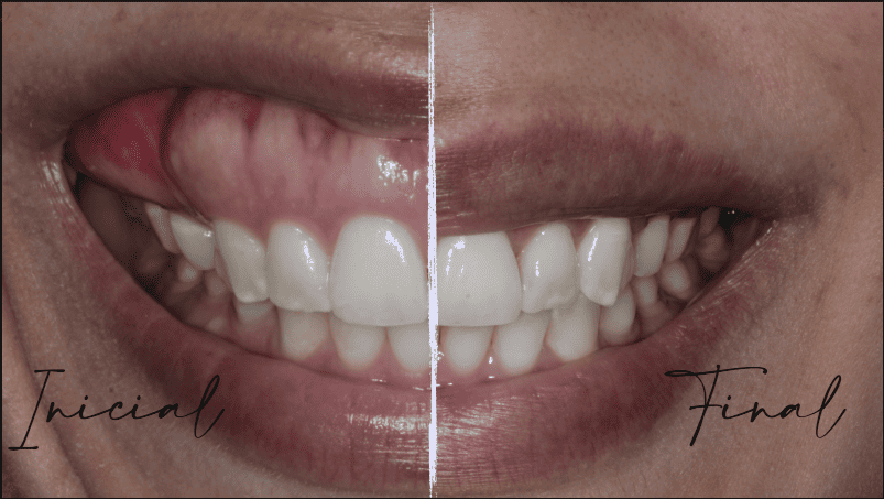 Imagem clínica RLE3